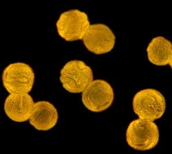 pollen from dandelions